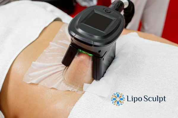 Does Fat Freezing at Home Work? DIY Devices vs Professional Cryolipolysis 1 How is professional cryolipolysis different Prestwich?