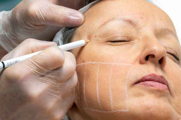 CryoPen: 5 Skin Concerns It May Be Used to Treat 4 What should you ask before having CryoPen treatment Prestwich?