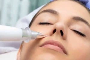 Best Actinic Keratoses Removal 3 Actinic keratoses Prestwich solutions - book in today!