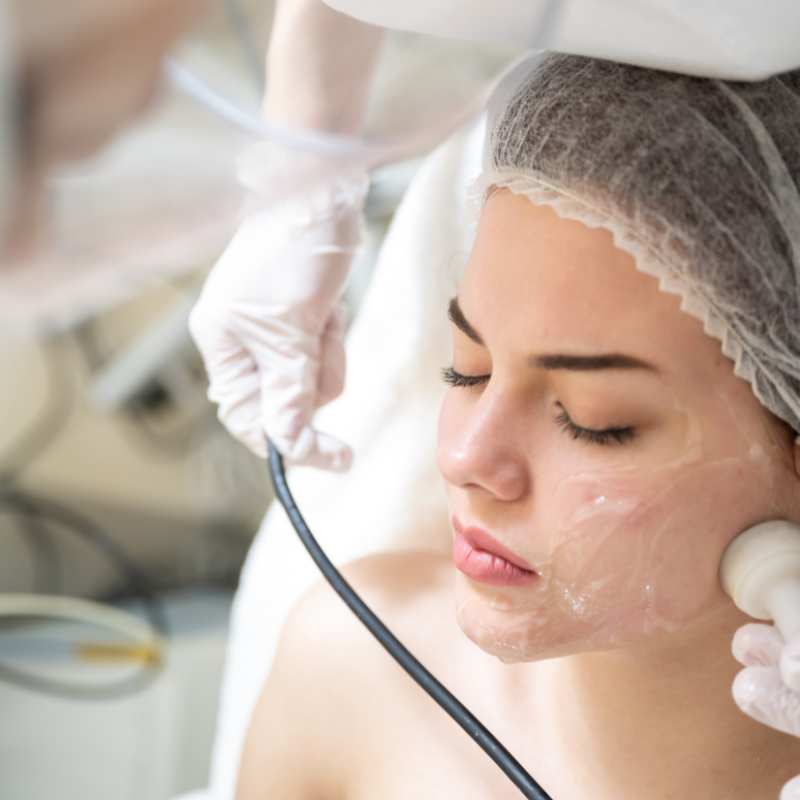 Why Do People Choose HIFU for a Non-Surgical Facelift? 5 What are the risks Prestwich?