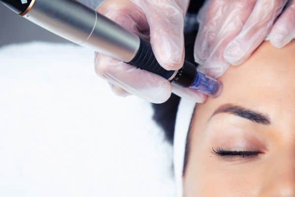 Explaining Total Skin Tightening Treatment and What to Expect 2 What Skin Concerns Can Total Skin Tightening Treatment Help With Prestwich?